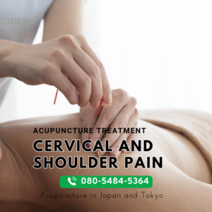 Acupuncture for Shoulder Pain in Tokyo: A Comprehensive Guide to Relief and Recovery