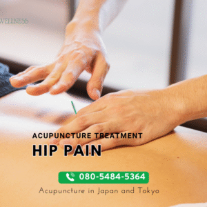 Hip Pain and Acupuncture Treatment in Tokyo: A Comprehensive Guide to Relief and Recovery