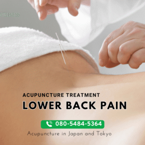 Lower Back Pain and Acupuncture: A Comprehensive Guide to Relief