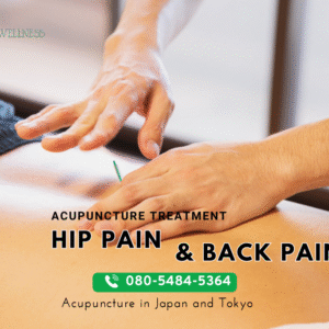 Herniated Discs and Acupuncture Treatment in Tokyo